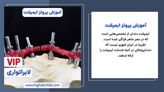 آموزش پروتز ایمپلنت