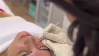 مراحل فیشیال صورت + بهترین نتیجه ❤️ کاشت ریش
