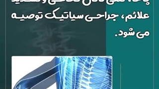 چه موقع باید سیاتیک را عمل کرد؟