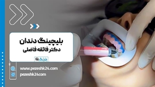 دکتر فائقه فاضلی بهترین جراح لثه و ایمپلنت دندان تهران اصلاح طرح لبخند