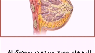 ماموگرافی دقیق تر است یا سونوگرافی؟