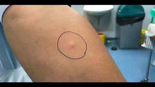 ازمایش سلفری چیست