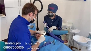 فیلم ایمپلنت یک روزه