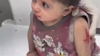 کودک معصوم فلسطینی که شوکه شده و دیگر خانواده ای ندارد