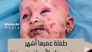 Let the world see the crime of infanticide by the Israeli regime