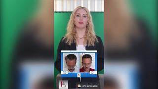 زراعة الشعر فی هلیا: نتائج طبیعیة وطویلة الأمد