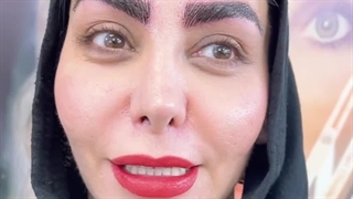 مرکز تخصصی ابرو چشم لب