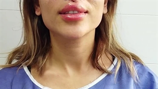 لیفت سانترال لب