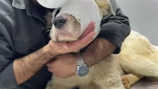 پیوند پوست سر به چشم. جراحی کم نظیر