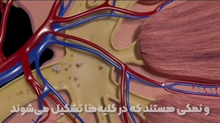 آزمایش سنگ کلیه