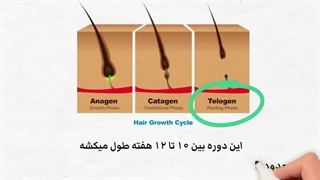 دلیل ریزش مو چیه!؟
