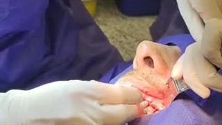 متخصص ایمپلنت شرق تهران