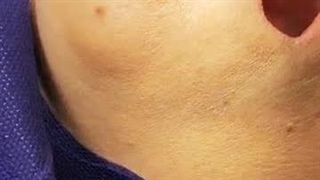 ایمپلنت کار حرفه ای حسین آباد