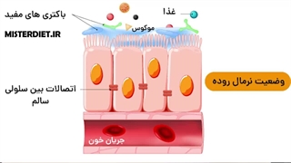 درمان بیماری سیلیاک
