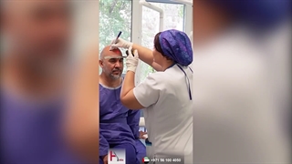 کیفیة تحقیق کثافة شعر عالیة: زراعة الشعر فی هیلیا