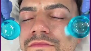 فیشیال صورت مزوتراپی