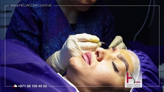 کم من الوقت تستغرق عملیة زراعة الحواجب؟ | عیادة هلیا