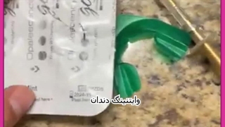 سفید کردن دندان جراحی پف زیر چشم