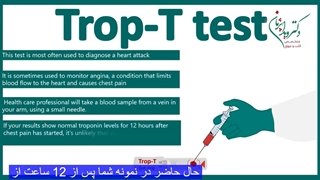 آزمایش تروپونین چیست؟