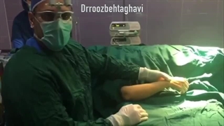 فیلم جراحی تنیس البو