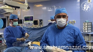 عمل همزمان اسلیو معده و سنگ کیسه صفرا