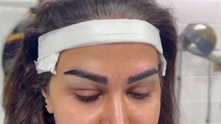 کات ابرو دائمی در کلینیک آرتین