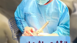 انگشت ماشه ای