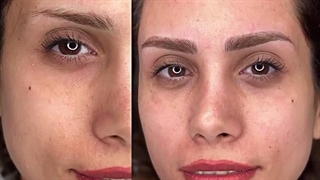 مرکز تخصصی ابرو چشم لب