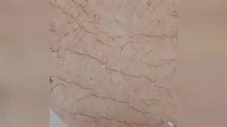 پیچ و رولپلاک نما