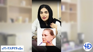 ویژگی های دندان مصنوعی