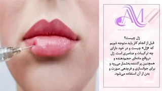 چقدر راجب تزریق ژل میدونی