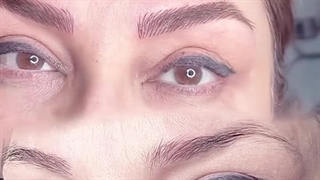 مرکز تخصصی ابرو چشم لب