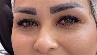 مرکز تخصصی ابرو چشم لب