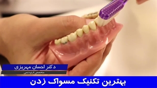 بهترین تکنیک مسواک زدن