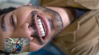 ایمپلنت قدیمی شده اینو ببین