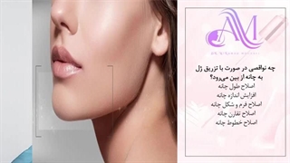 میدونی با تزریق ژل به چانه چقدر چهره ات بهتر میشه؟