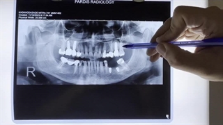 دندانپزشکی نزدیک قیطریه