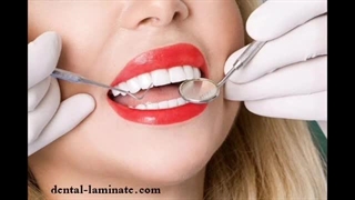 لیمنت سرامیکی چیست و کاربرد آن