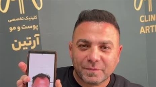کاشت مو در کلینیک آرتین