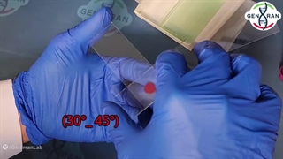 آموزش تهیه لام خون محیطی