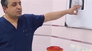 نکات مهم درباره سیاه شدن سر استخوان ران