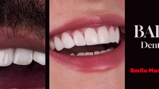 خنده های زیبا؛ ارمغان بارانا برای شما