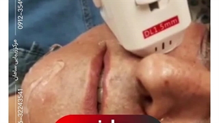 هایفو 7 بعدی در کرج