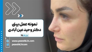 دکتر وحید عین آبادی بهترین جراح بینی شیراز اینسایزینگ