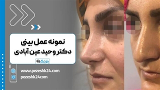دکتر وحید عین آبادی بهترین جراح بینی در شیراز ترمیم دندان
