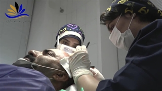 بهترین کاشت مو در شیراز - بهترین روش کاشت