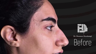 جراحی همزمان فک و صورت