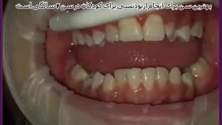 ارتودنسی لیزر صورت