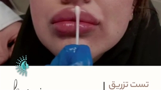 تزریق تخصصی ژل در کرج