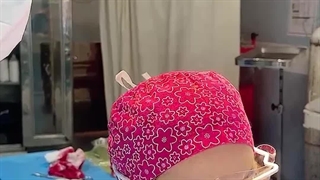 لابیاپلاستی و پرینوپلاستی